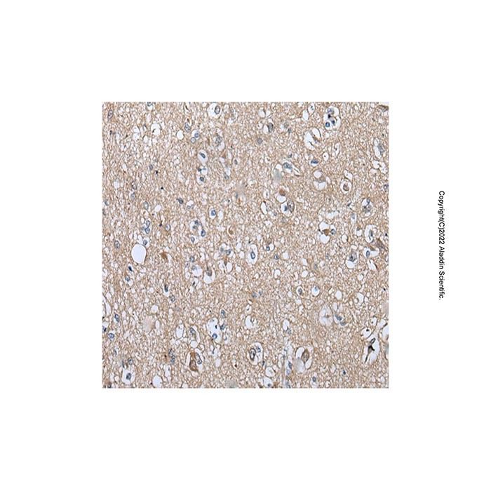 WIPI2 Antibody -    by Aladdin Scientific