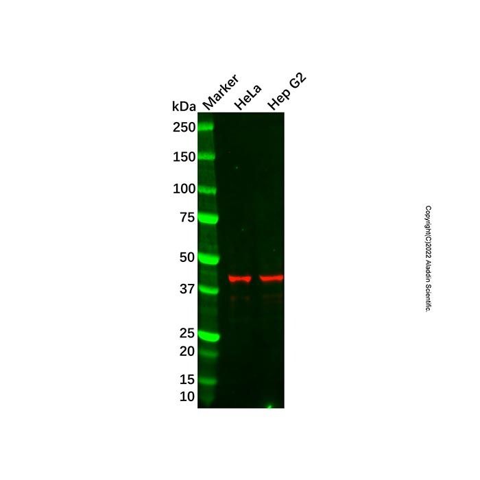 Recombinant XRCC3 Antibody -    by Aladdin Scientific