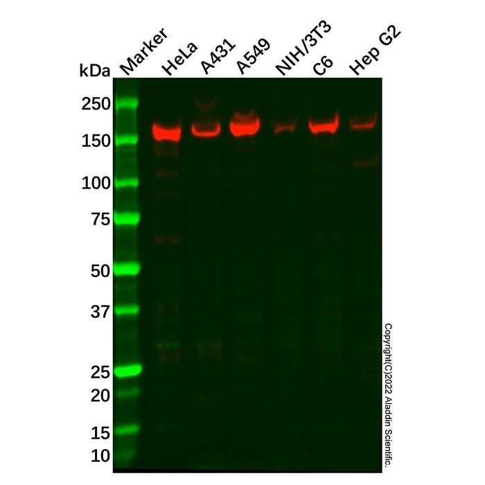 Recombinant YTHDC2 Antibody -    by Aladdin Scientific