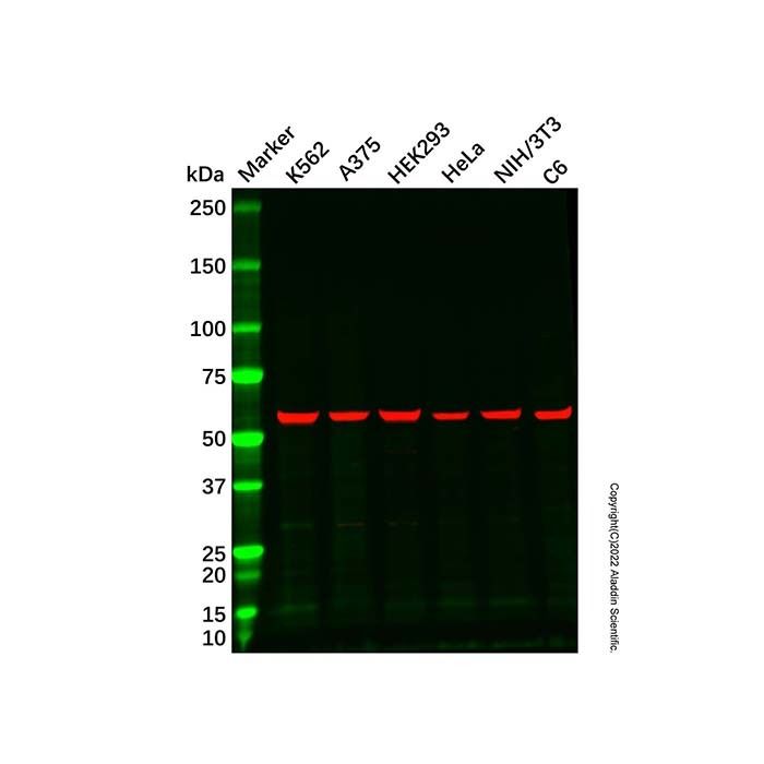 Recombinant YY1 Antibody  -    by Aladdin Scientific