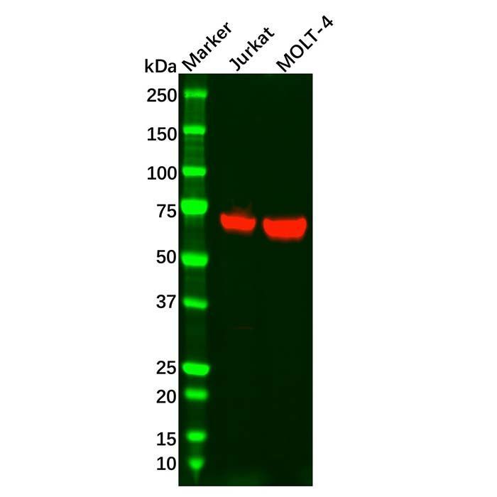 Recombinant ZAP70 Antibody -    by Aladdin Scientific