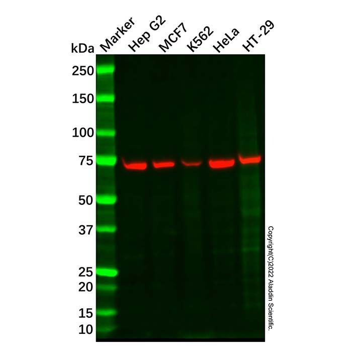 Recombinant Pokemon/ZBTB7A Antibody -    by Aladdin Scientific
