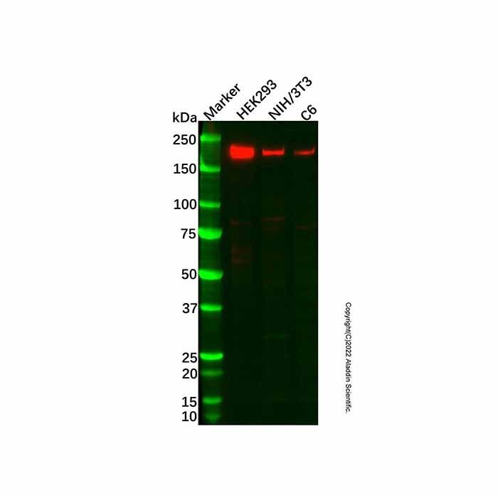 Recombinant ZEB1 Antibody -    by Aladdin Scientific