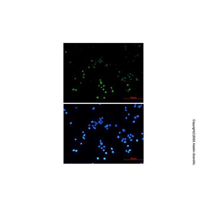 Recombinant ZHX2 Antibody -    by Aladdin Scientific