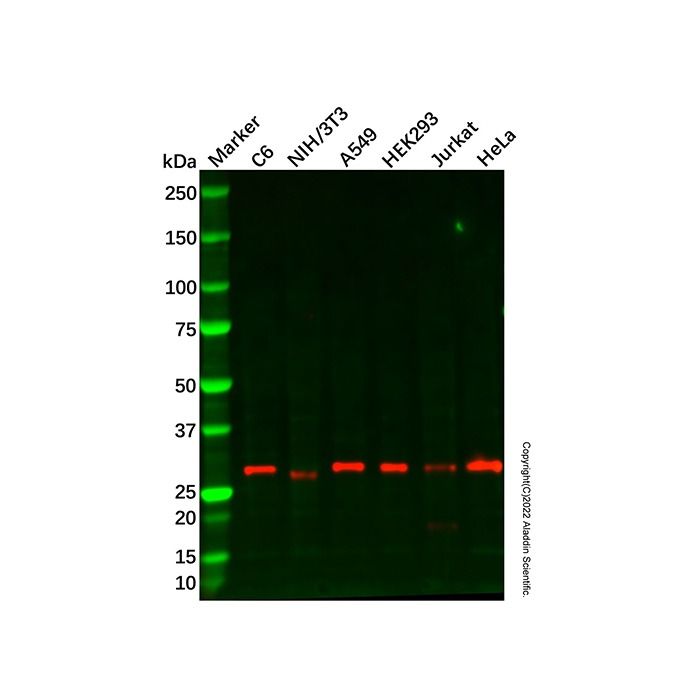 Recombinant ZNRF2 Antibody - by Aladdin Scientific