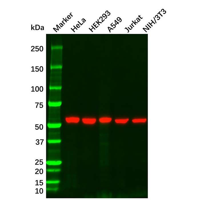 Vimentin Mouse mAb - by Aladdin Scientific
