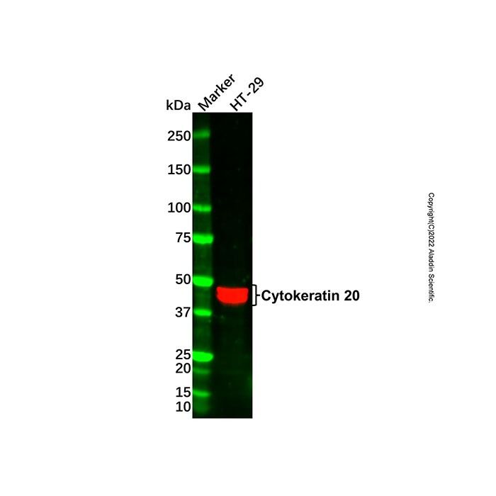 Cytokeratin 20 Mouse mAb -    by Aladdin Scientific