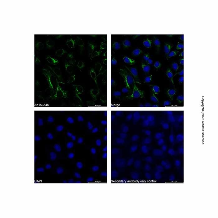 Iba1 Mouse mAb -    by Aladdin Scientific