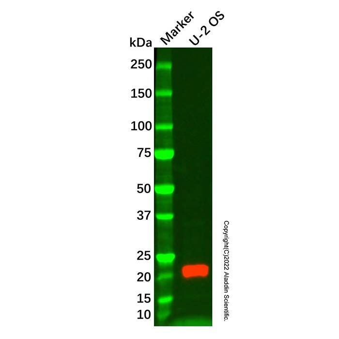 IL-18 Mouse mAb -    by Aladdin Scientific