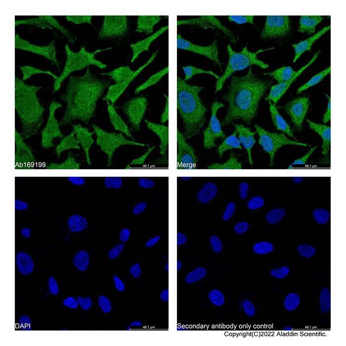 beta 2 Microglobulin Mouse mAb -    by Aladdin Scientific