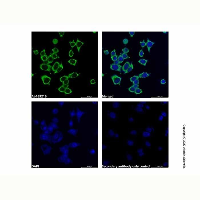 iNOS Mouse mAb - by Aladdin Scientific