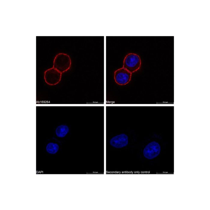 Goat Anti-Human IgG (TRITC) - by Aladdin Scientific
