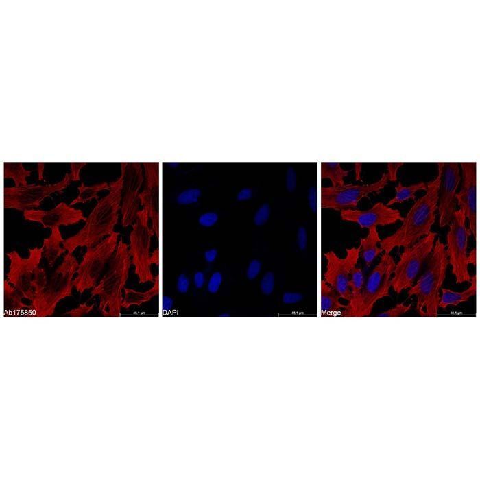beta Actin Mouse mAb (Biotin) - by Aladdin Scientific