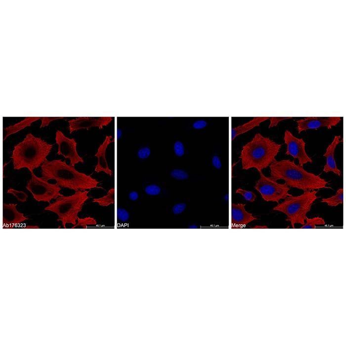 beta Actin Mouse mAb (TRITC) - by Aladdin Scientific