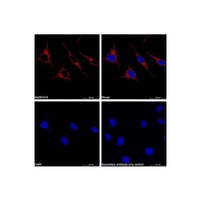 Goat Anti-Rabbit IgG H&L (APC) - by Aladdin Scientific