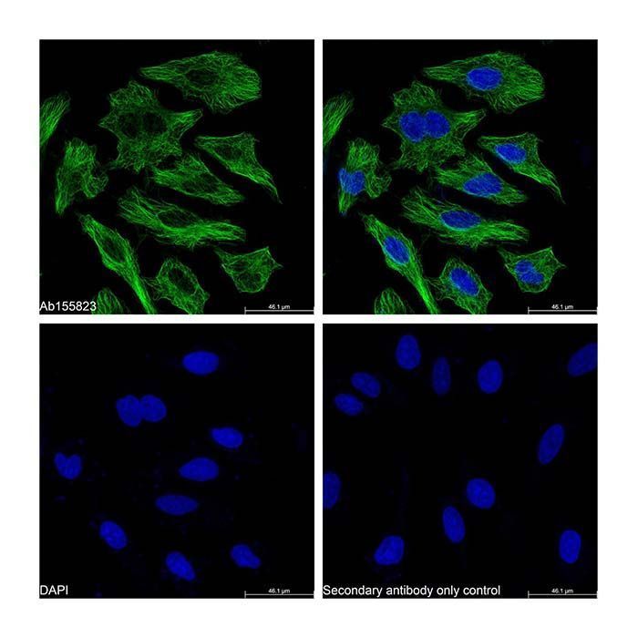Goat Anti-Mouse IgG H&L (Biotin) -    by Aladdin Scientific