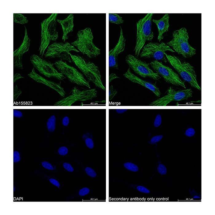 Goat Anti-Mouse IgG H&L (FITC) - by Aladdin Scientific