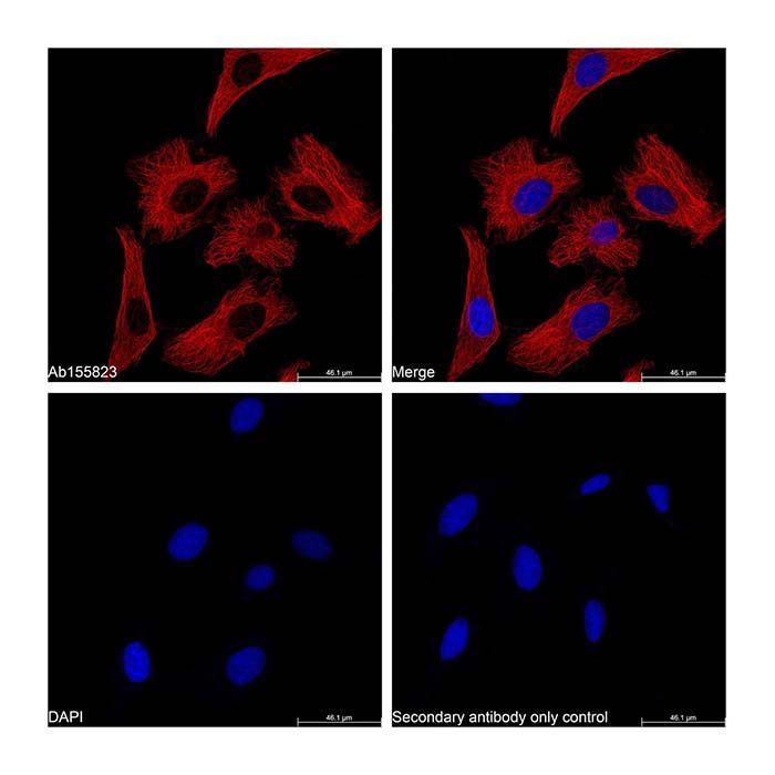 Goat Anti-Mouse IgG H&L (Cy5) -    by Aladdin Scientific