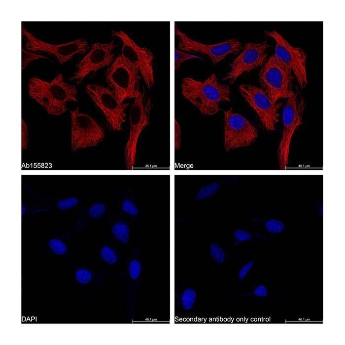 Goat Anti-Mouse IgG H&L (TRITC) -    by Aladdin Scientific