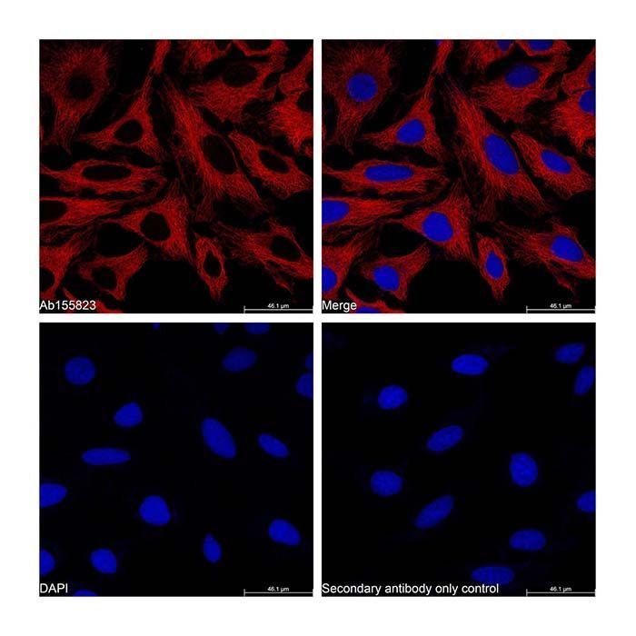 Goat Anti-Mouse IgG H&L (APC) - by Aladdin Scientific