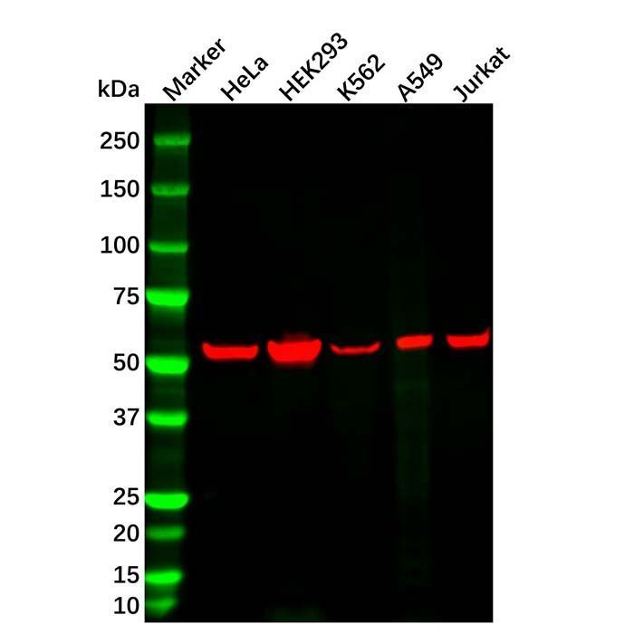 Vimentin Mouse mAb - by Aladdin Scientific