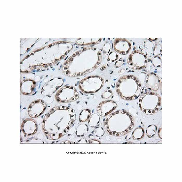 MOB1B Mouse mAb -    by Aladdin Scientific