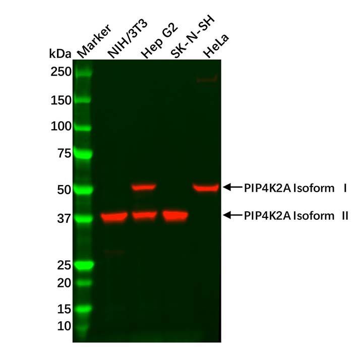 PIP4K2A Antibody -    by Aladdin Scientific