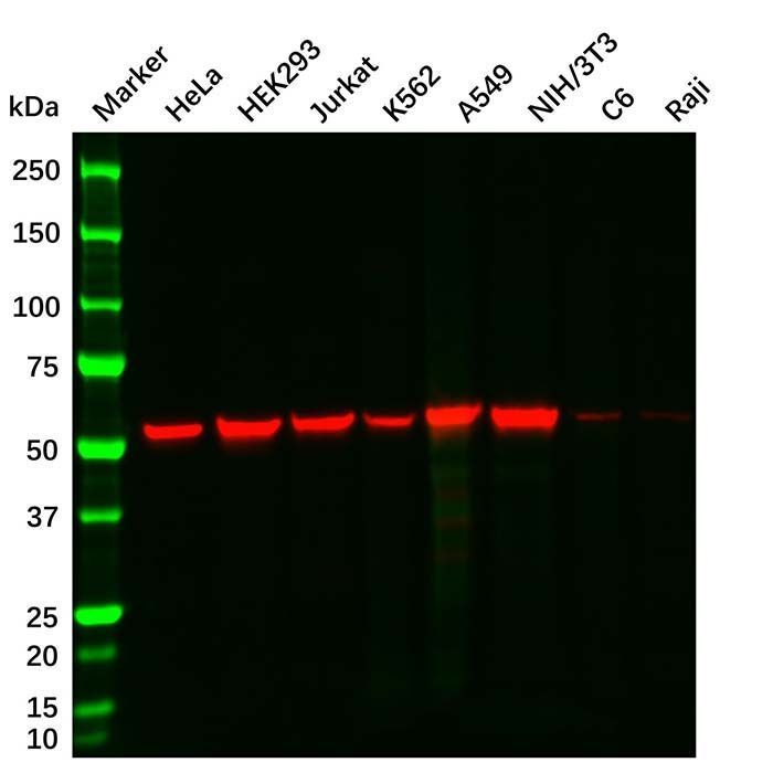 Vimentin Mouse mAb - by Aladdin Scientific