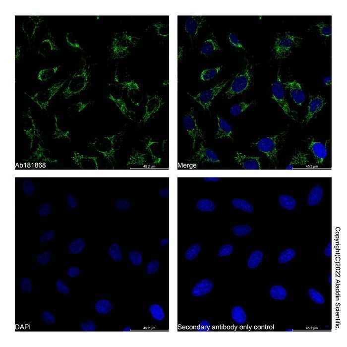 COX IV Mouse mAb -    by Aladdin Scientific