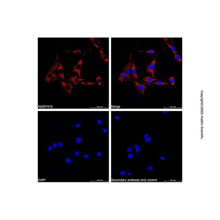 Goat Anti-Rabbit IgG H&L (AF555) -    by Aladdin Scientific