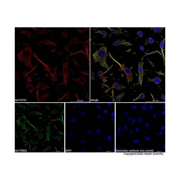 IgG anti-conejo de cabra H&L (AF647) -    by Aladdin Scientific