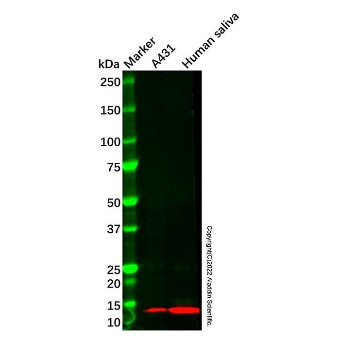 Recombinant S100A8 Antibody -    by Aladdin Scientific