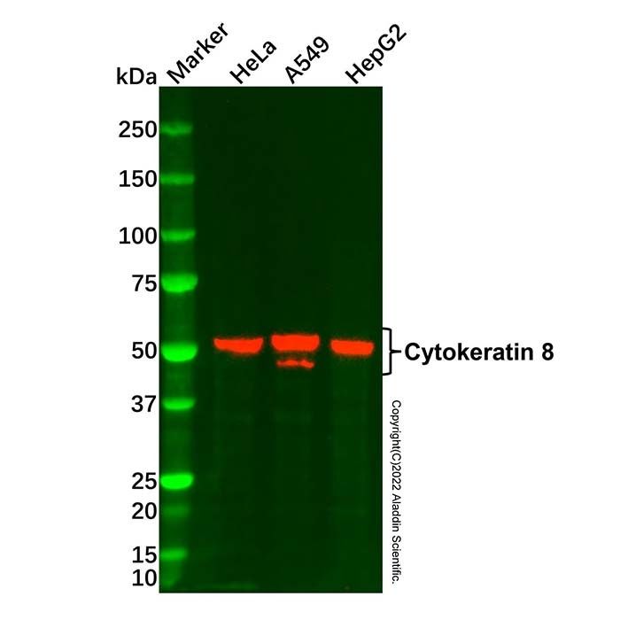 Cytokeratin 8 Mouse mAb -    by Aladdin Scientific