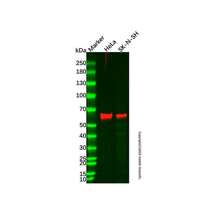 Cytokeratin 9 Mouse mAb -    by Aladdin Scientific