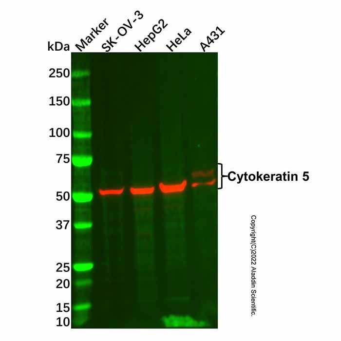 Cytokeratin 5 Mouse mAb -    by Aladdin Scientific