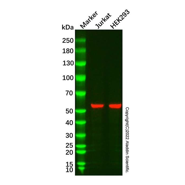 AKT2 Mouse mAb -    by Aladdin Scientific