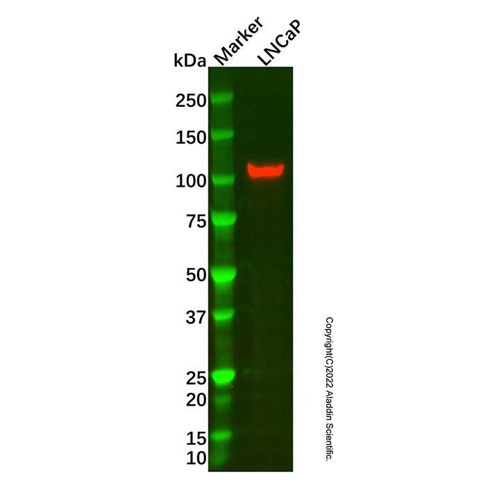 E-Cadherin Mouse mAb -    by Aladdin Scientific