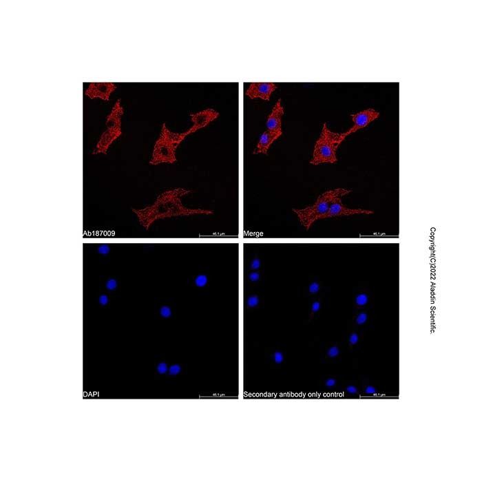 alpha-Smooth Muscle Actin Mouse mAb - by Aladdin Scientific