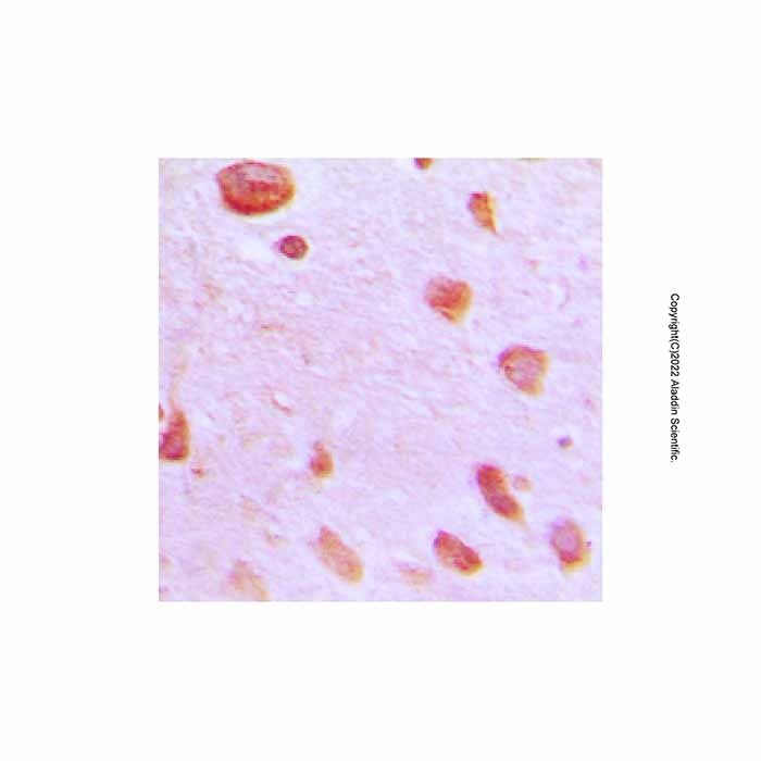 TUBGCP5 Antibody -    by Aladdin Scientific