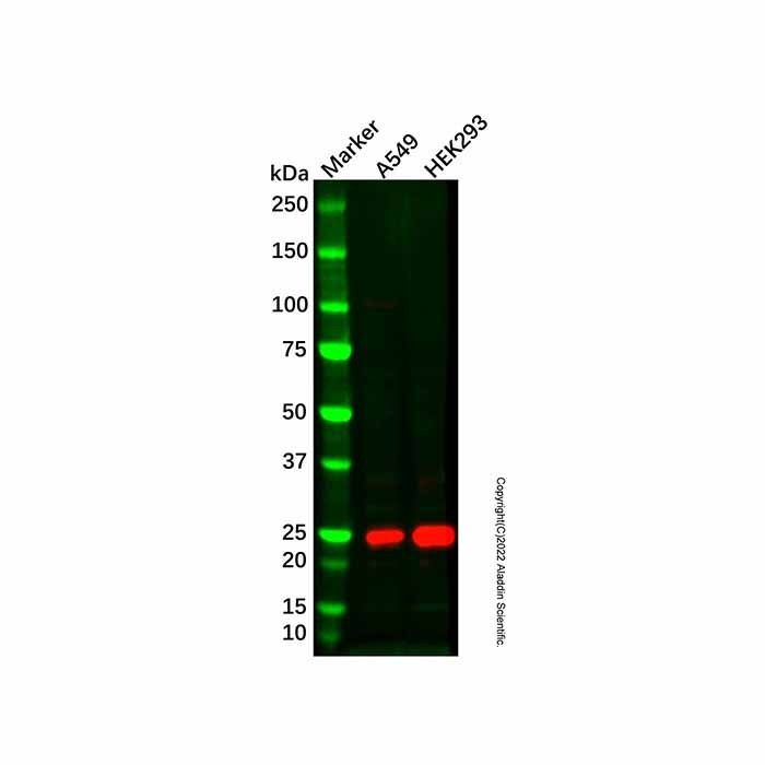 TCEAL6 Antibody -    by Aladdin Scientific