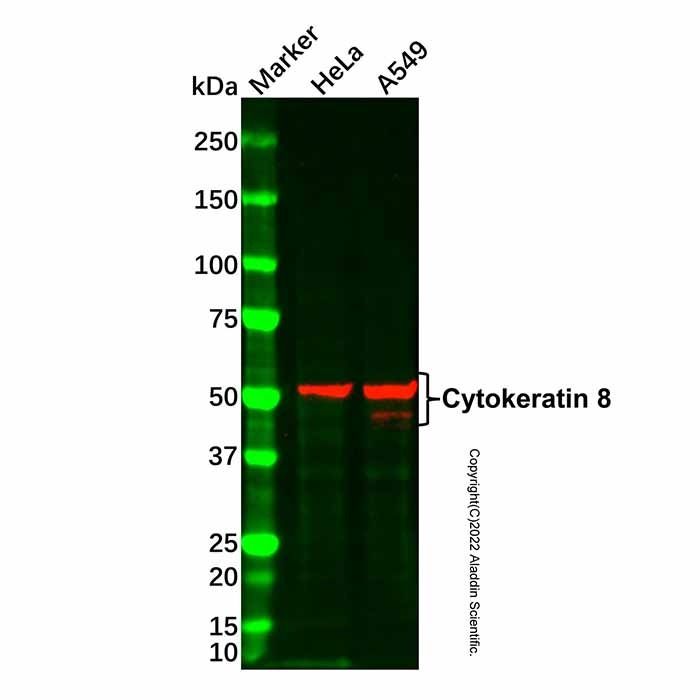 Cytokeratin 8 Mouse mAb -    by Aladdin Scientific