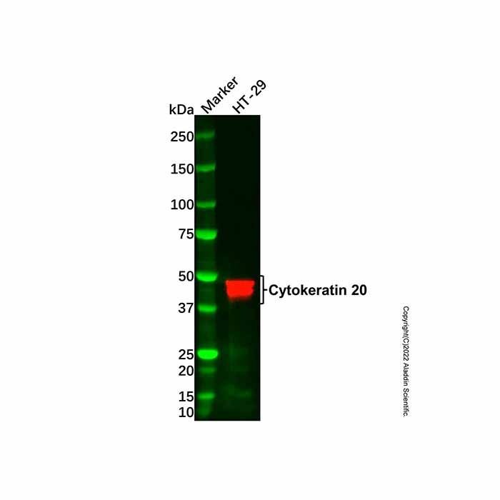 Cytokeratin 20 Mouse mAb -    by Aladdin Scientific