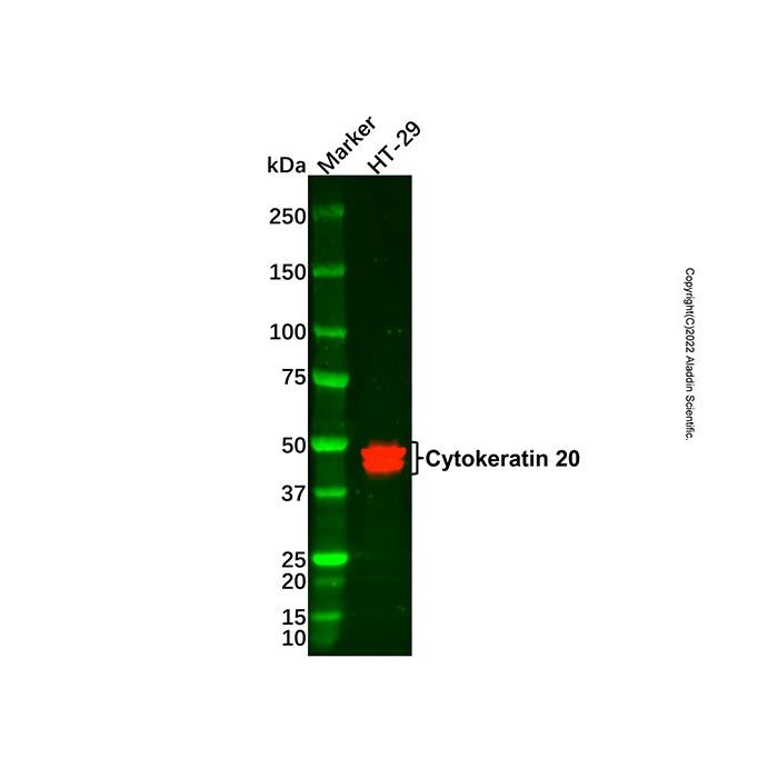 Cytokeratin 20 Mouse mAb -    by Aladdin Scientific