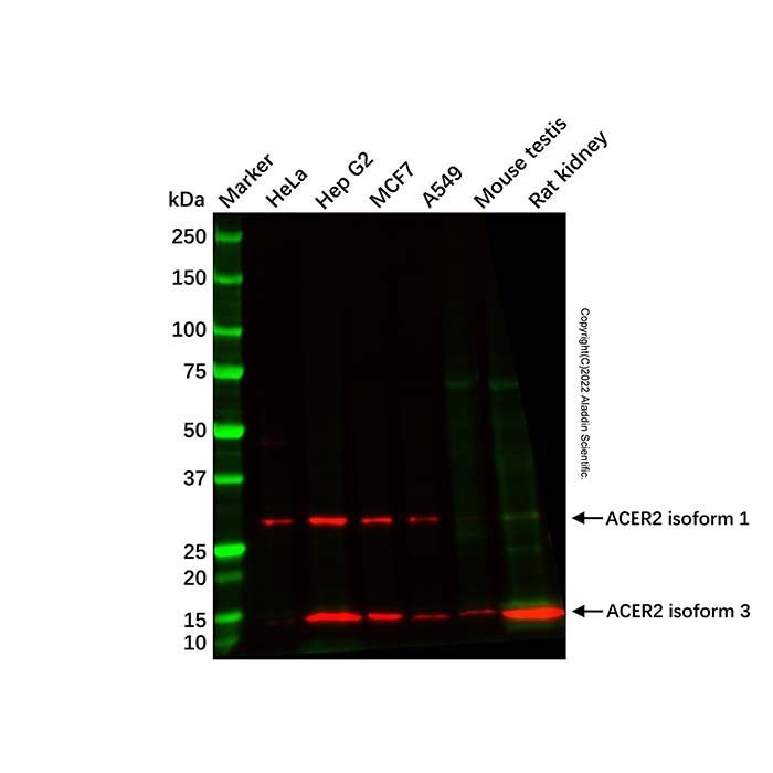 ACER2 Antibody -    by Aladdin Scientific