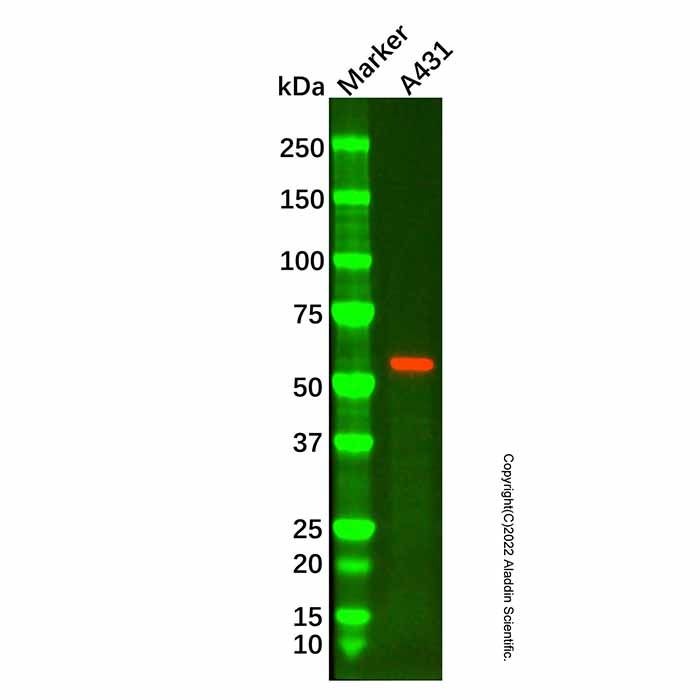 Cytokeratin 6 Mouse mAb -    by Aladdin Scientific