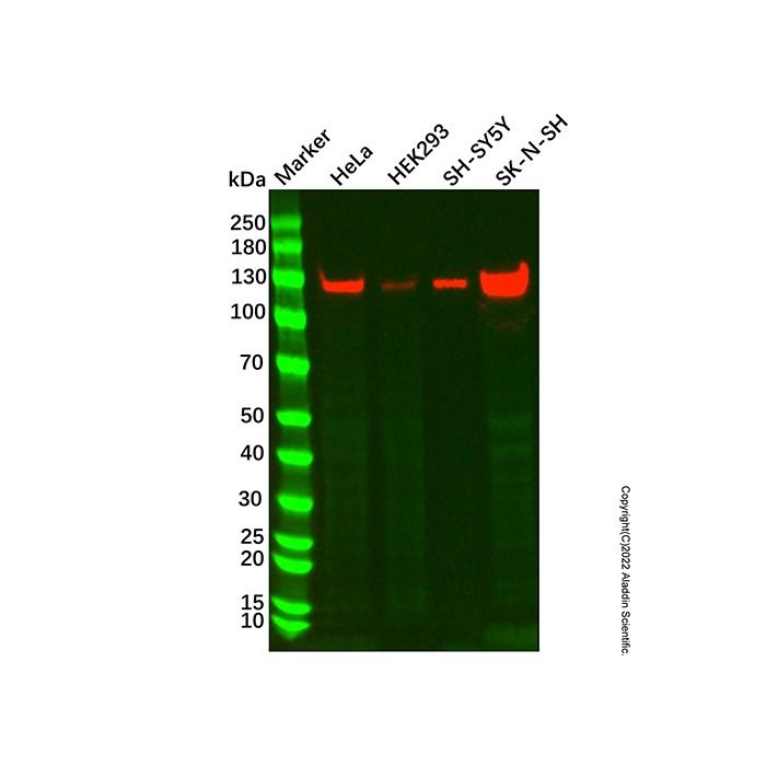 N Cadherin Mouse mAb -    by Aladdin Scientific