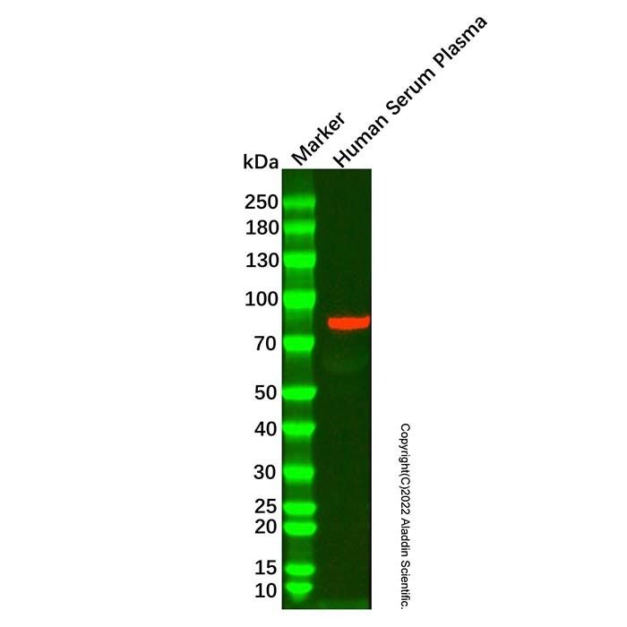 Transferrin Mouse mAb -    by Aladdin Scientific