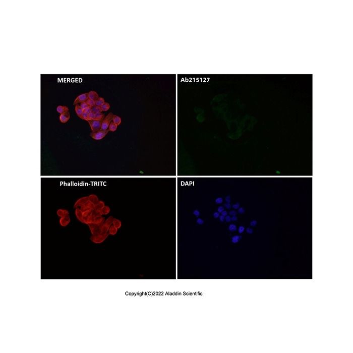 Recombinant FAT10 Antibody -    by Aladdin Scientific