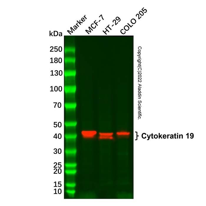 Cytokeratin 19 Mouse mAb -    by Aladdin Scientific