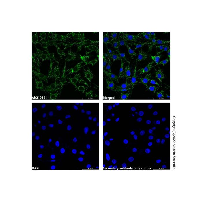 Cyclophilin B Mouse mAb (Biotin) - by Aladdin Scientific